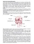 Anterior Cruciate Ligament Injuries Pre-op patient information