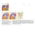 Impingement Syndrome & Tears of the Rotator Cuff