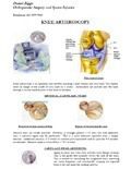 Knee Arthroscopy