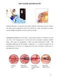 Shoulder Arthroscopy