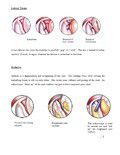 Shoulder Arthroscopy